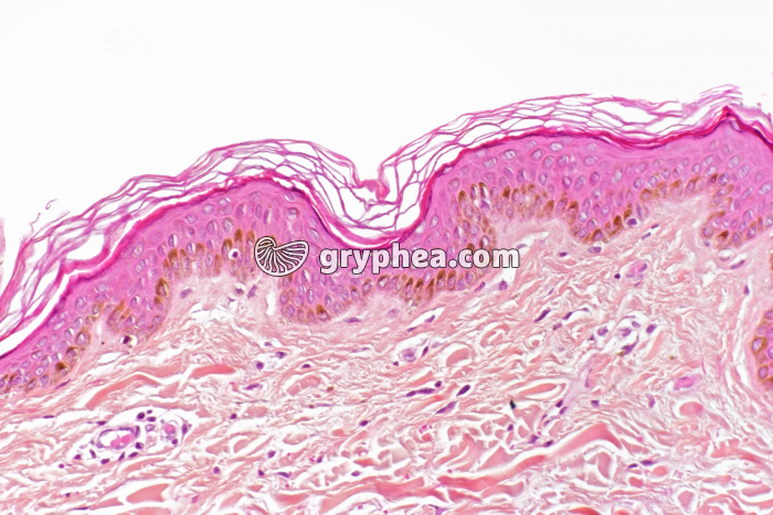 Peau race noire CT x70 - gryphea.org